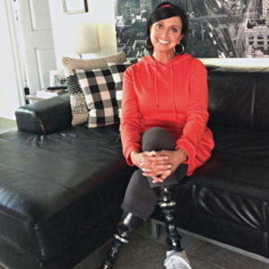 Scleroderma survivor, Christi Hoehn at home.